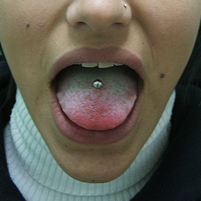 tongue